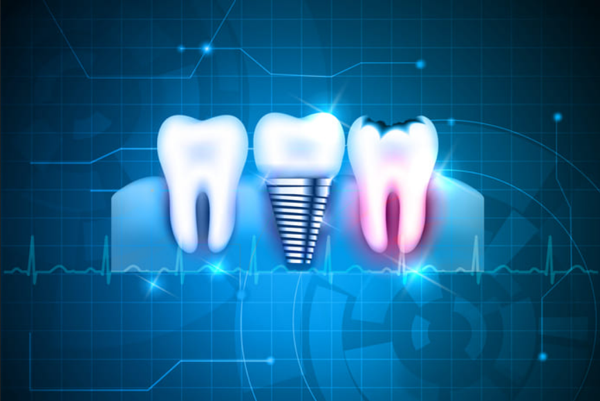 La evolución de la tecnología dental reflejada en 6 avances